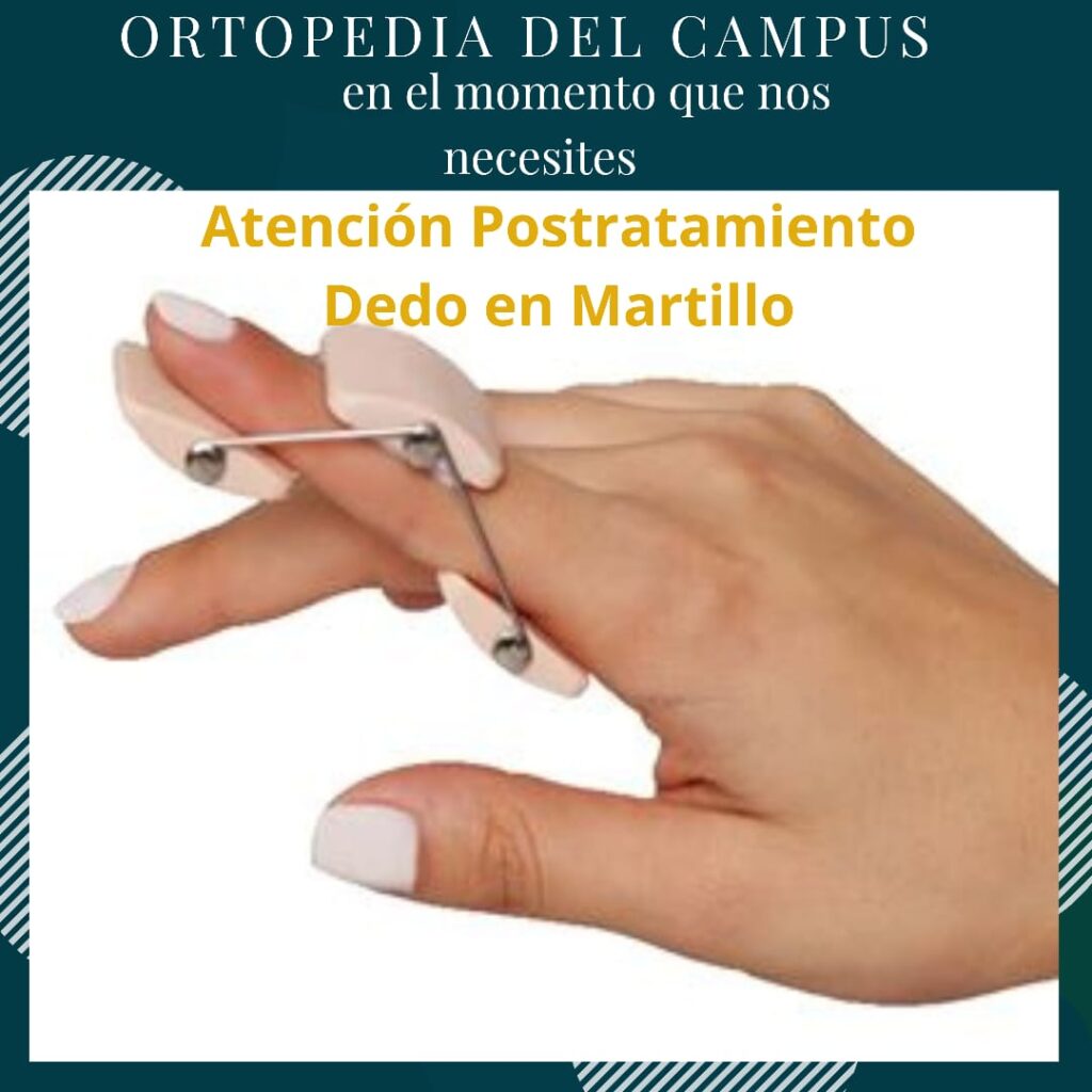 Atención Postratamiento del Dedo en Martillo