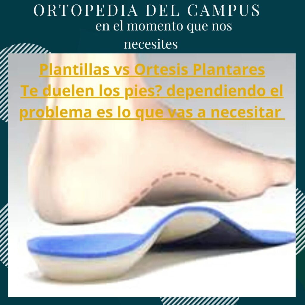 Plantillas vs Ortesis Plantares