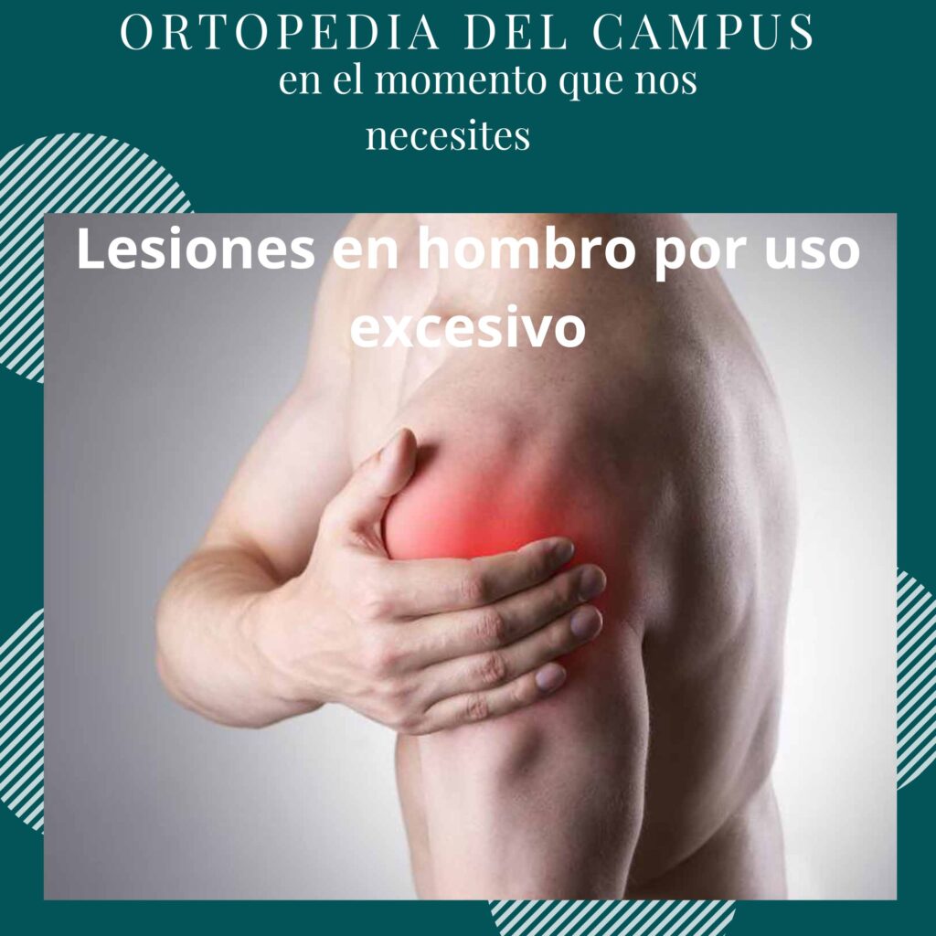 Lesiones en Hombro por uso excesivo