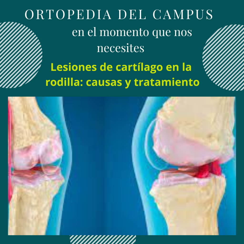 Lesiones de cartílago en la rodilla: causas y tratamiento